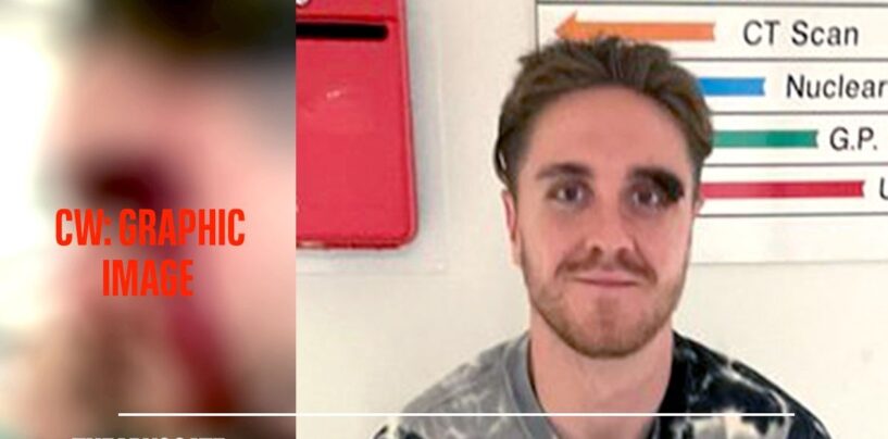 Un couple gay battu par un gang homophobe armé d’un morceau de bois cloué