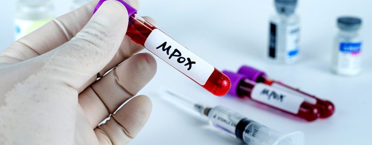 L'Organisation mondiale de la santé déclare à nouveau que le mpox est une urgence sanitaire mondiale face à la menace croissante des cas