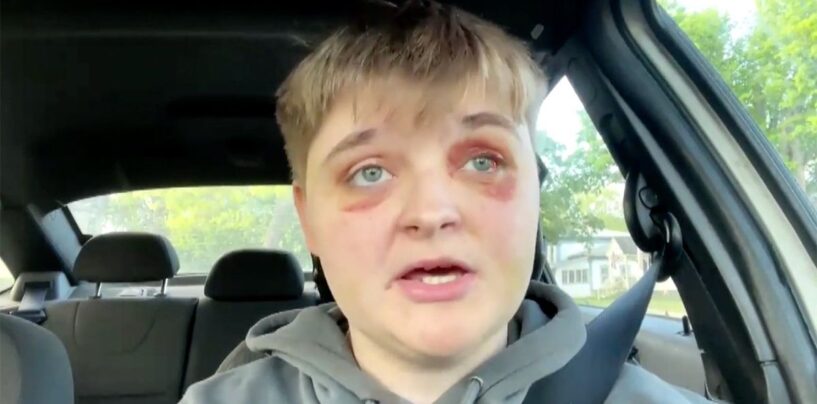 L'adolescent lesbien a brutalement battu à l'Illinois McDonald's dans le crime de haine potentiel