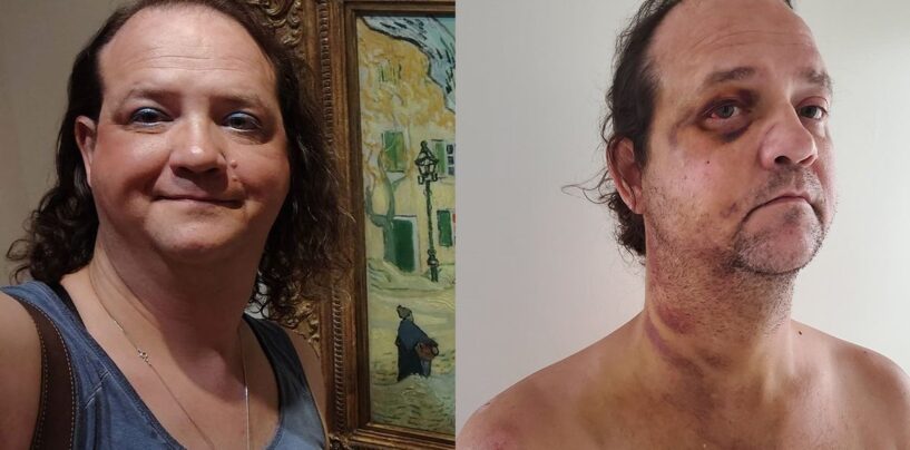 Femme transgenre qui a échappé à l'Alabama pour sa sécurité battu et est parti pour mort près du National Mall à DC