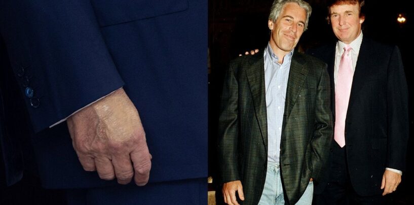 Des épouses à l'IRS, Trump s'est toujours caché. Une main meurtrie et Epstein le rendront enfin?