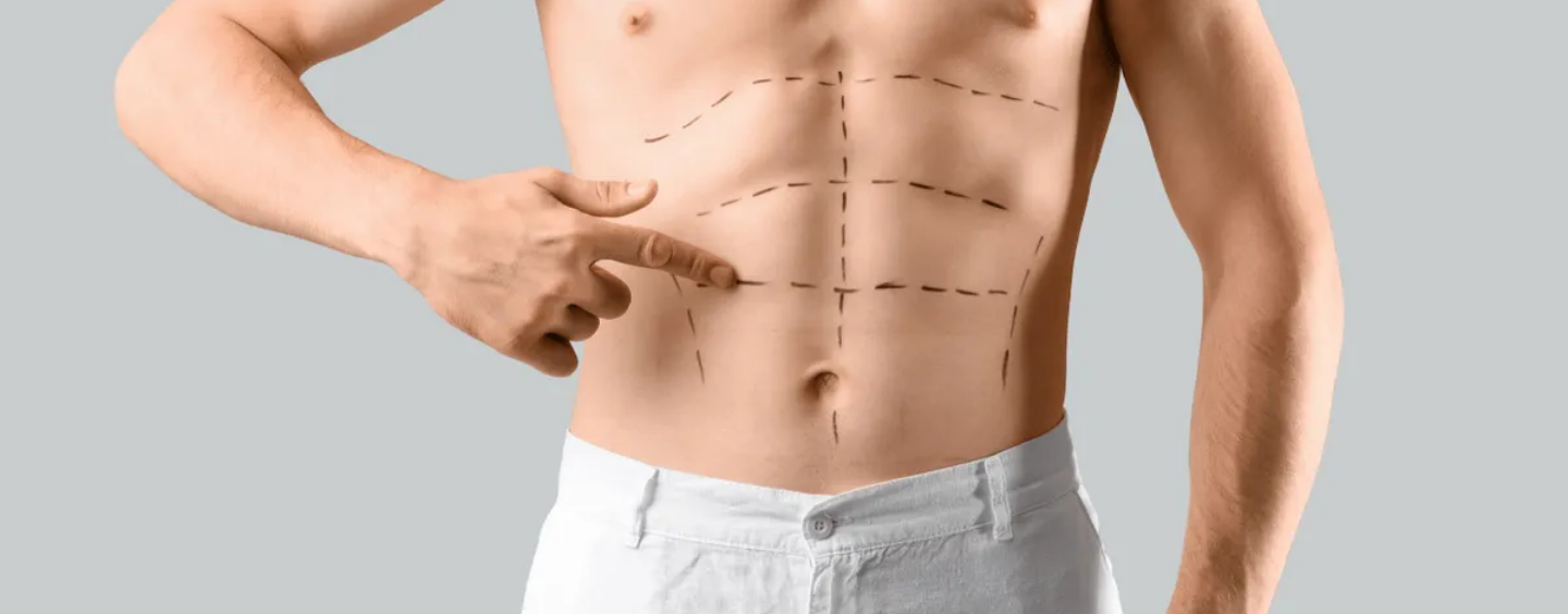 Les hommes cis adorent la chirurgie de pointe : elle devrait être accessible à tous