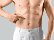 Les hommes cis adorent la chirurgie de pointe : elle devrait être accessible à tous