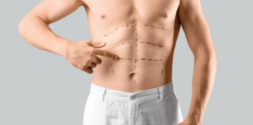 Les hommes cis adorent la chirurgie de pointe : elle devrait être accessible à tous